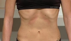 abdominales hipopresivos para reducir barriga